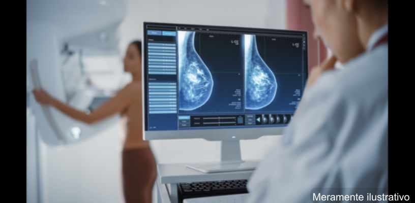Mamógrafo de alta precisão
