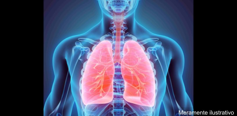 Aumento de casos de síndromes respiratórias no Paraná