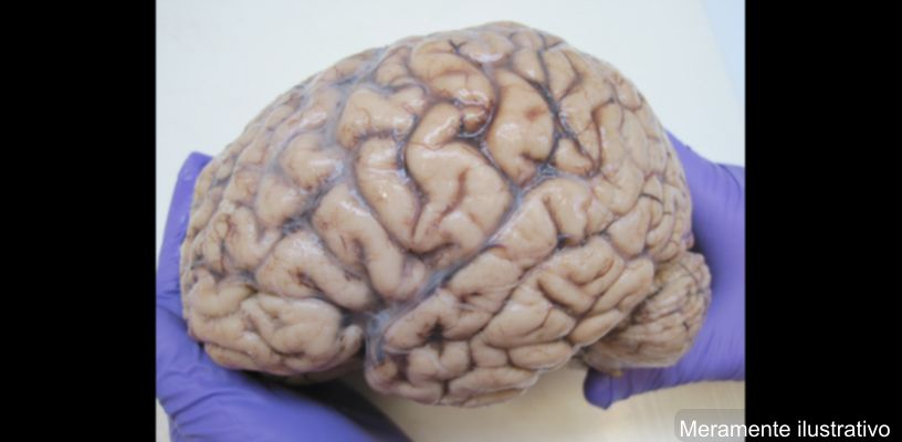 Cérebro humano